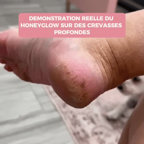 HoneyGlow™ - Kit Beauté Pieds
