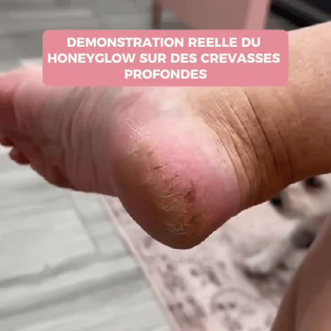 HoneyGlow™ - Kit Beauté Pieds