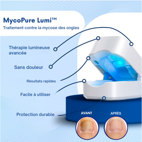 MycoPure Lumi™ - Traitement UV pour mycose des ongles