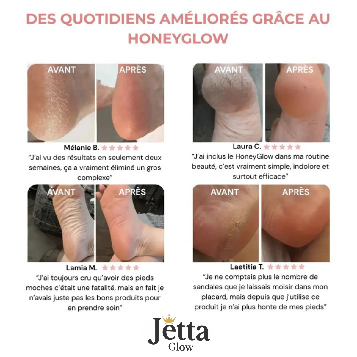 HoneyGlow™ - Kit Beauté Pieds