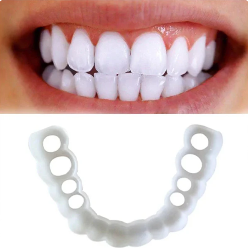 SOURIRE PARFAIT - FACETTES DENTAIRES INFÉRIEURES ET SUPÉRIEURES