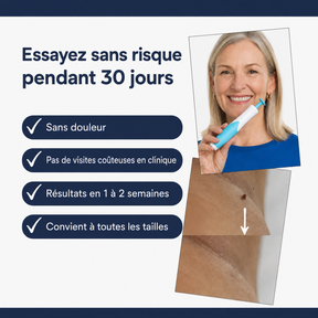SkinClear™ | Kit Anti-Acrochordons à Domicile