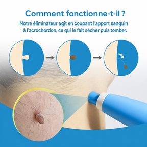 SkinClear™ | Kit Anti-Acrochordons à Domicile