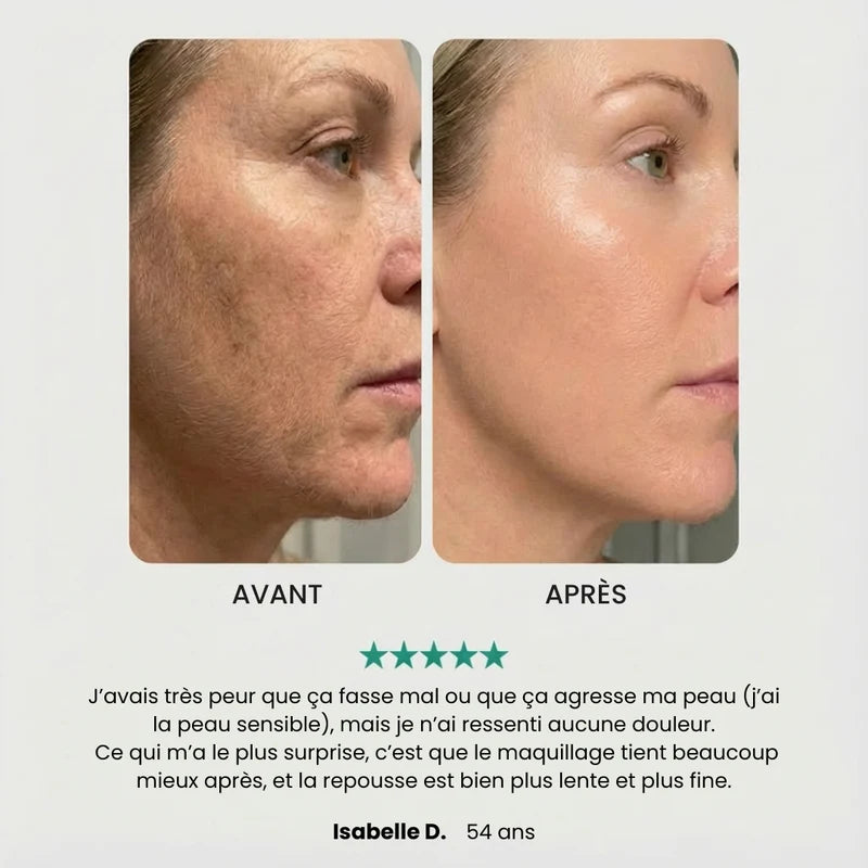 EpilSmooth Pro