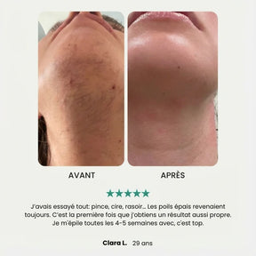 EpilSmooth Pro