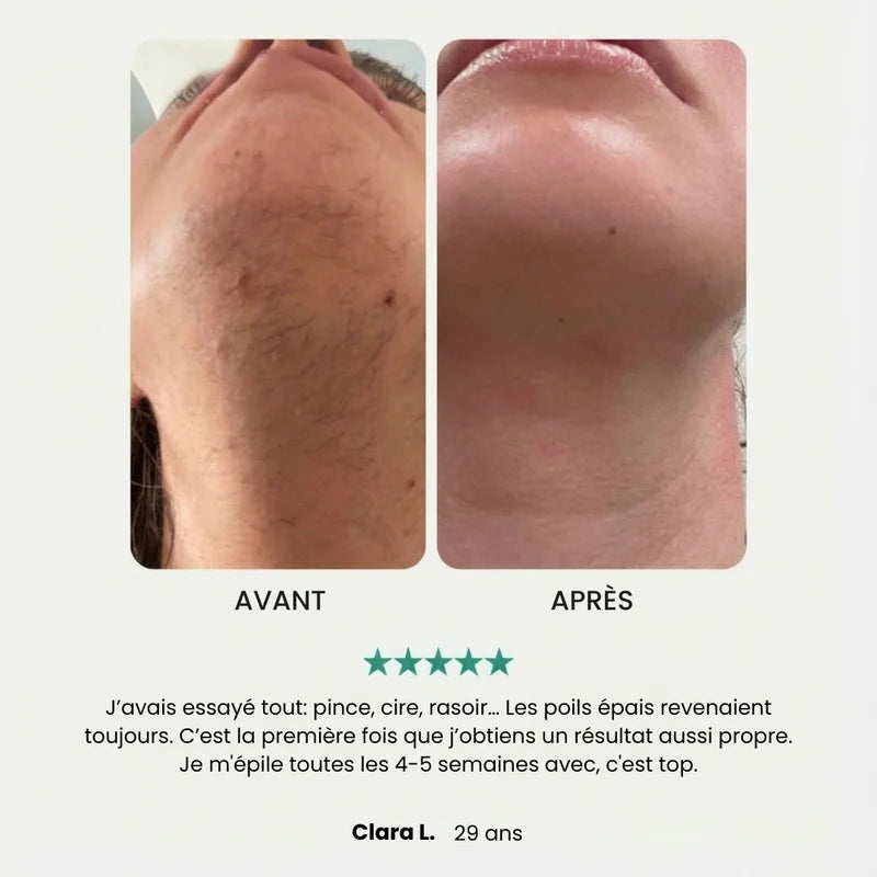 EpilSmooth Pro