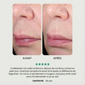 EpilSmooth Pro