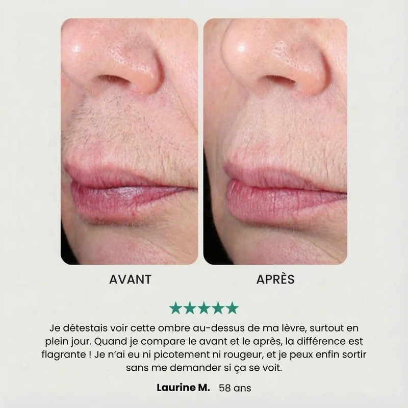 EpilSmooth Pro